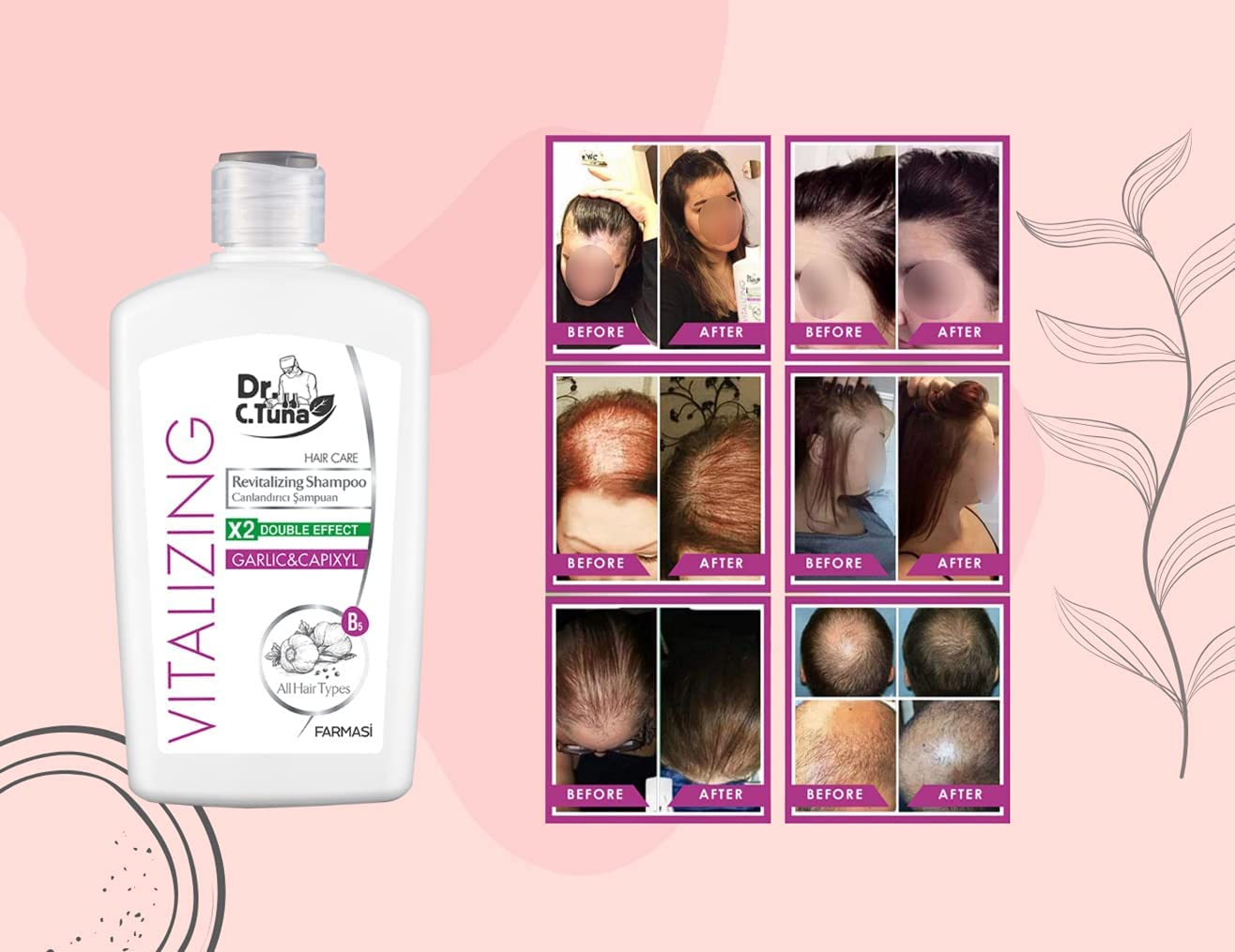 Farmasi Vitalising garlic shampoo 500 ml - protects against breakage and spills. Formula developed and enriched with garlic and capixy, 1108062